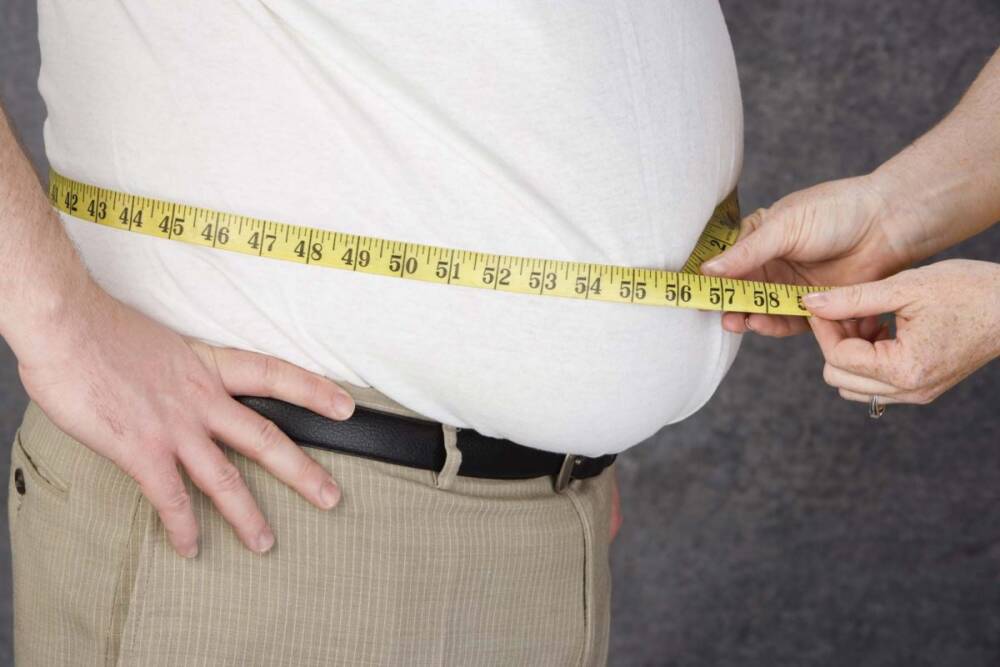 obesity | Definition, Causes, Health Effects, & Facts | Britannica