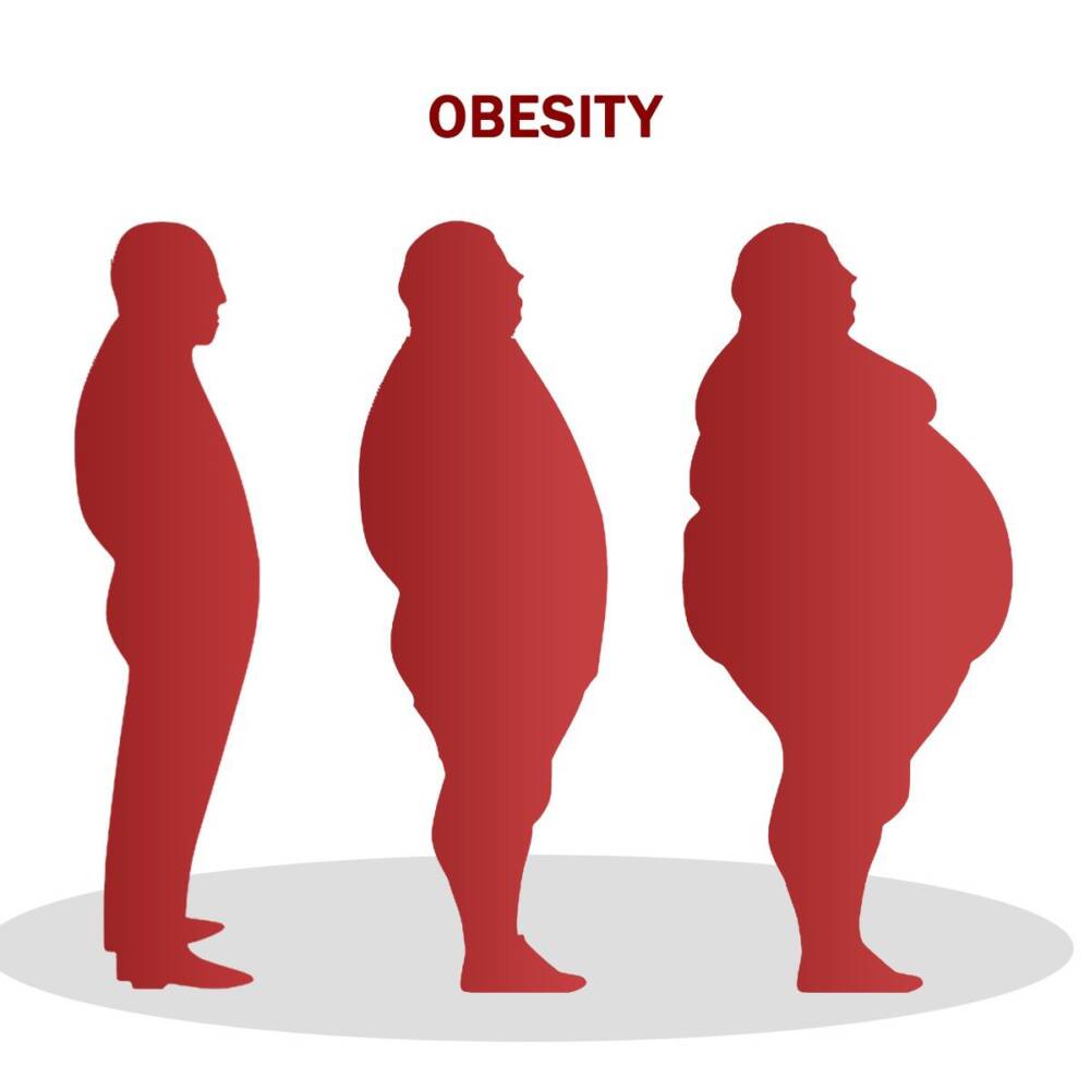 Obesity Treatment:Best surgery hospitals, Specialist doctors in coimbatore