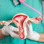 Phẫu thuật cắt bỏ tử cung (hysterectomy): Những điều bạn cần biết